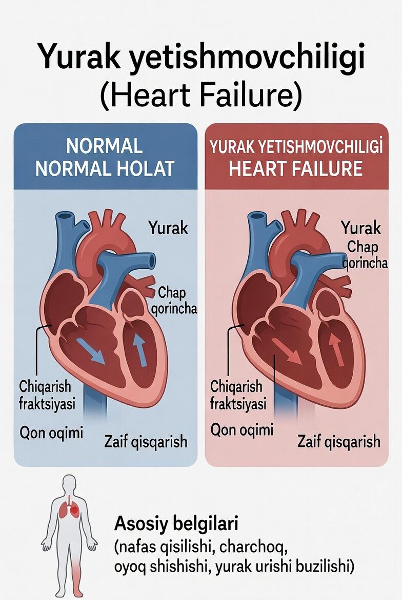 Yurak yetishmovchiligi