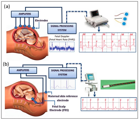 Homiladorlik monitoringi (ona va bola salomatligini nazorat qilish)