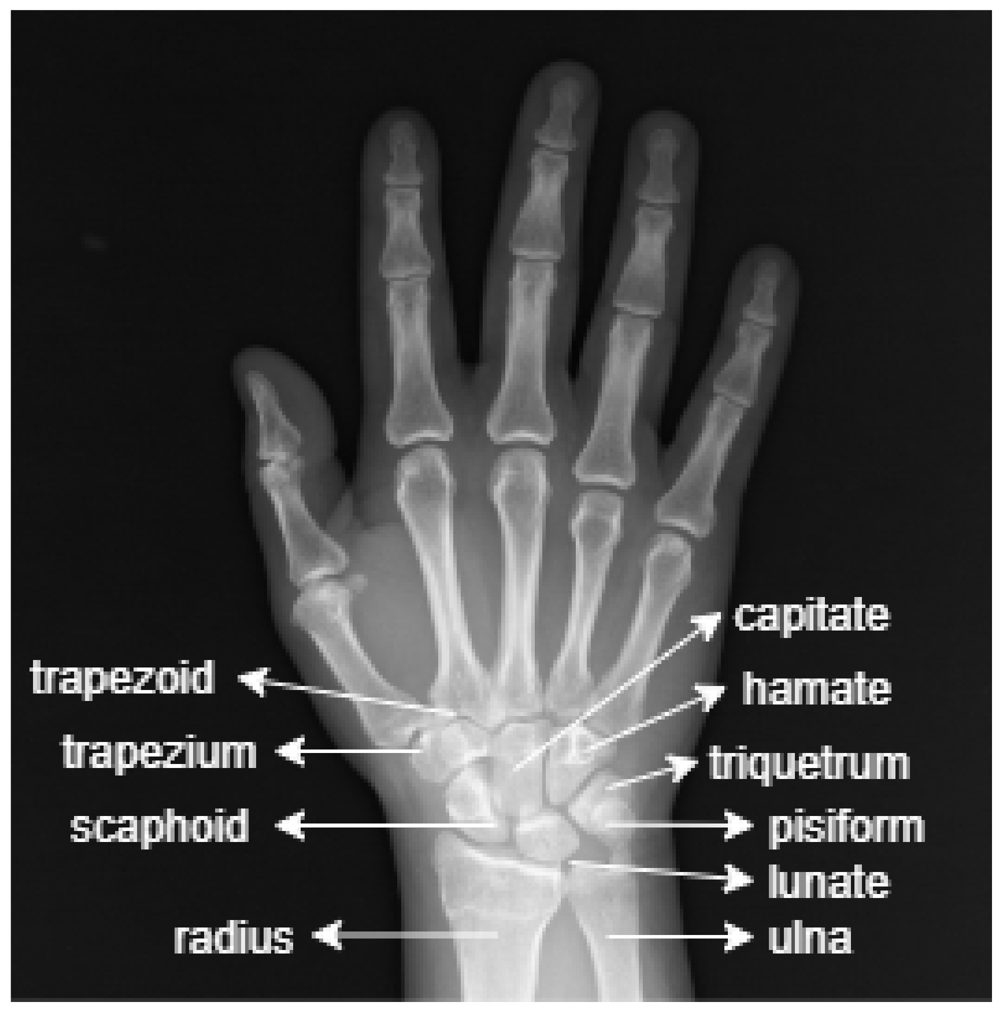 Sinishlarni aniqlash (raqamli rentgen yordamida)