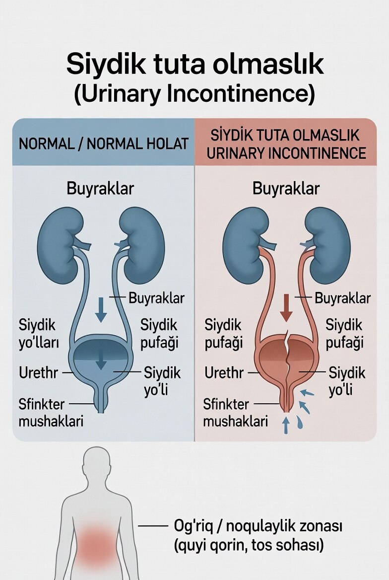 Siydik tuta olmaslik