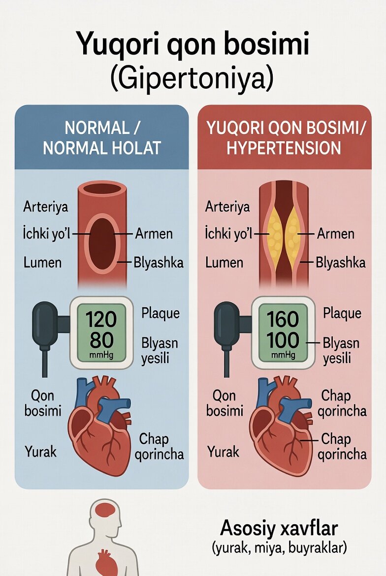 Gipertoniya (Yuqori qon bosimi)