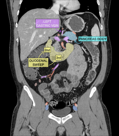 Abdominal CT Scan (Abdominal Organ Imaging)