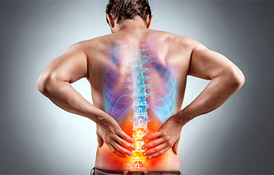 Bel og‘rig‘i (lumbago): kundalik hayotga ta’sir qiluvchi holat